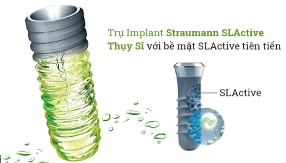 tru-implant